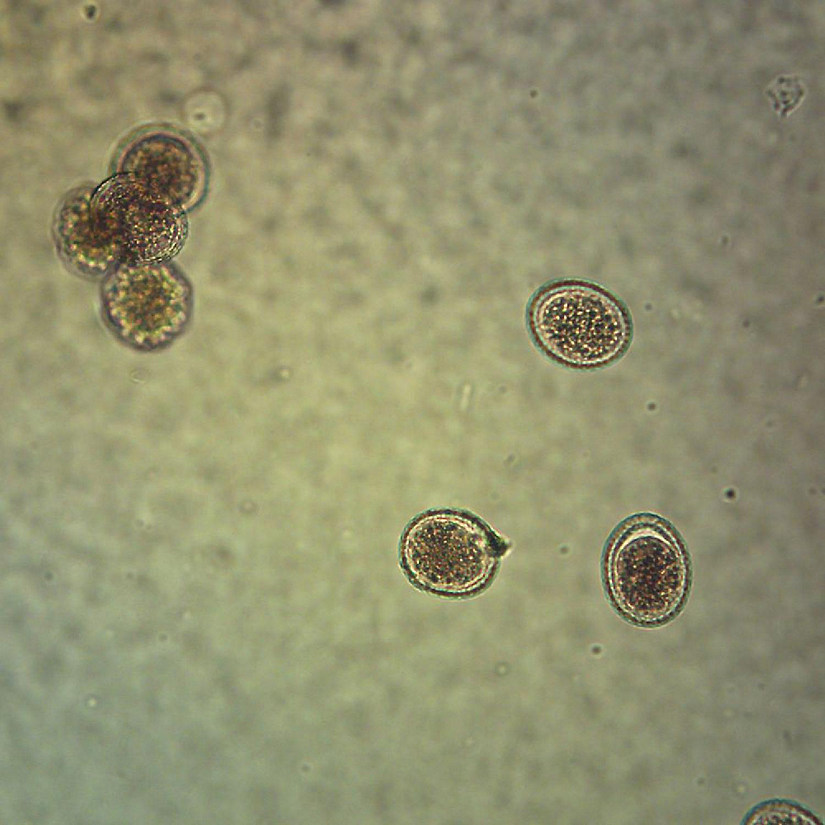 Carolina Biological Supply Company Ascaris lumbricoides Eggs, w.m. Microscope Slide Image