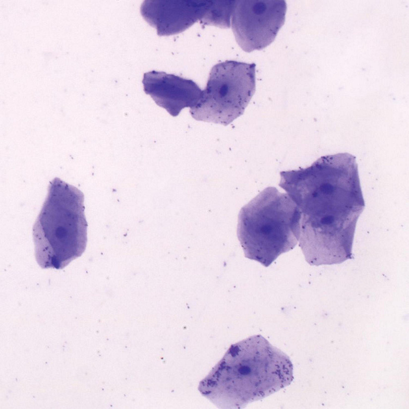 Carolina Biological Supply Company Human Stratified Squamous Epithelium Slide, Smear Image