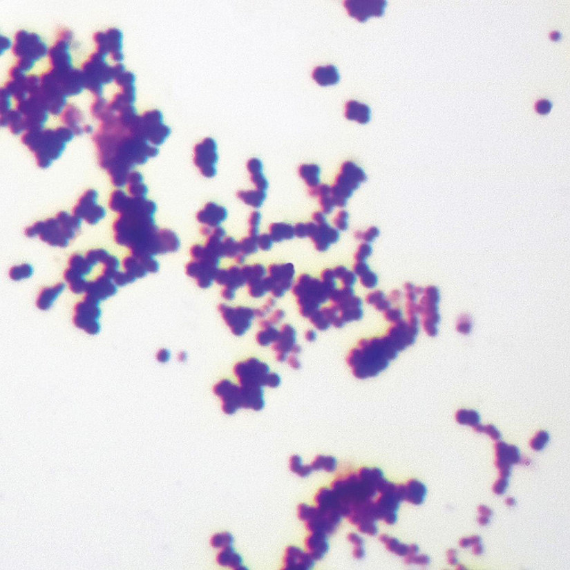 Carolina Biological Supply Company Mixed Gram-Positive & Gram-Negative Coccus, w.m. Gram Stain Microscope Slide Image