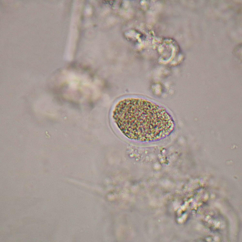 Carolina Biological Supply Company Necator americanus Eggs, w.m. Microscope Slide Image