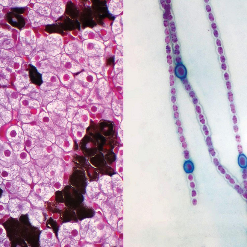 Carolina Biological Supply Company Prokaryotic and Eukaryotic Cells Individual Microscope Slide Image