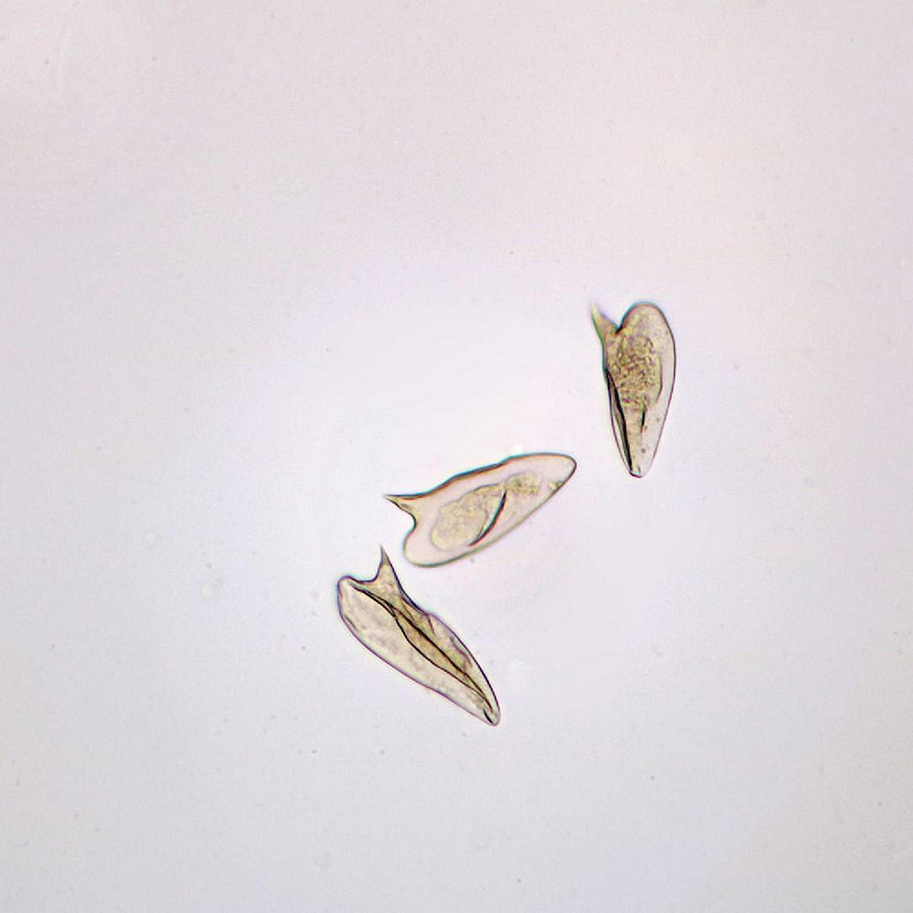 Carolina Biological Supply Company Schistosoma mansoni Eggs, w.m. Microscope Slide Image
