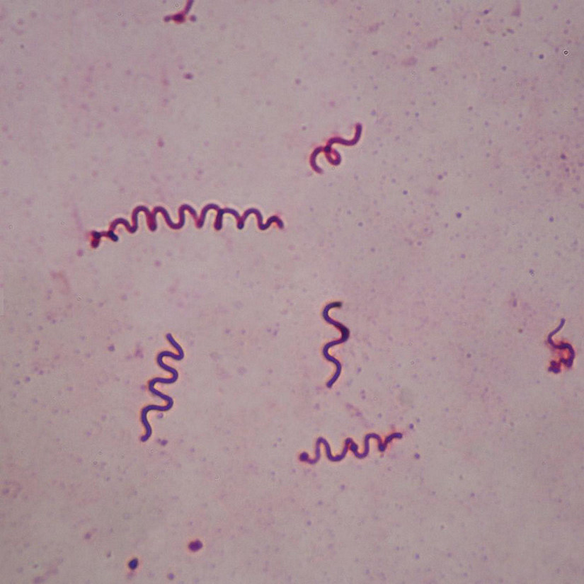 Carolina Biological Supply Company Spirillum volutans, w.m. Microscope Slide Image