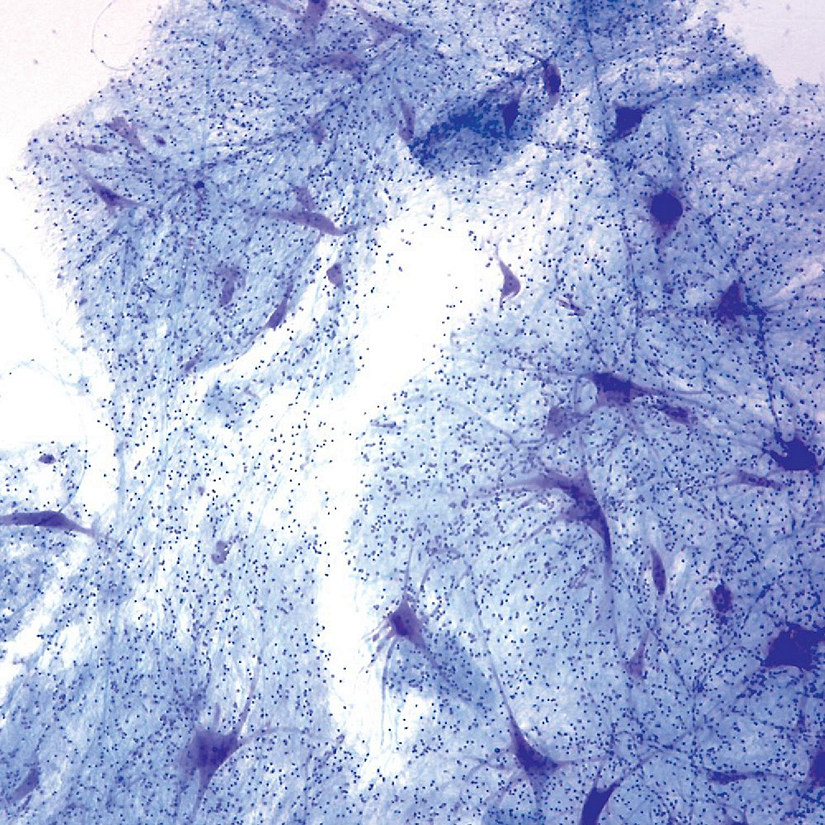 Mammal Giant Multipolar Neurons Slide, Smear, Luxol   Fast Blue Image