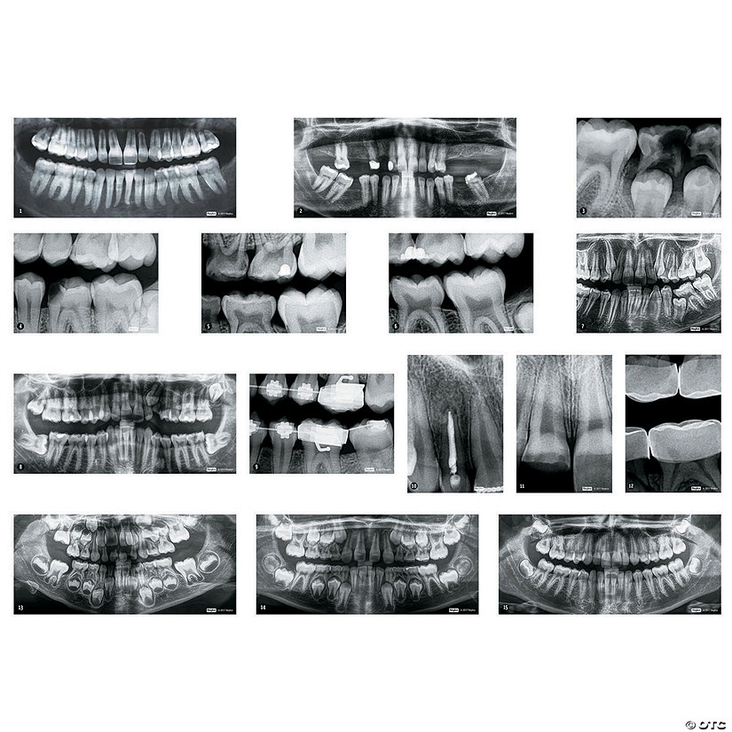 Roylco Dental Xrays Image