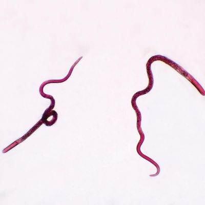 Carolina Biological Supply Company Trichinella spiralis Female, w.m. Microscope Slide Image 1