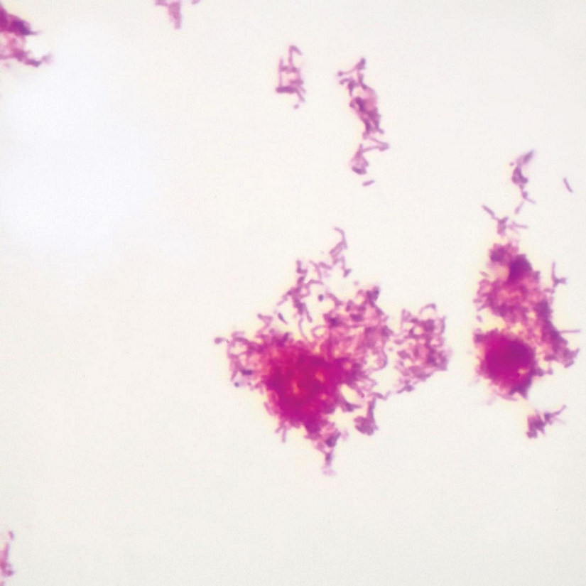 mycobacterium smegmatis gram stain