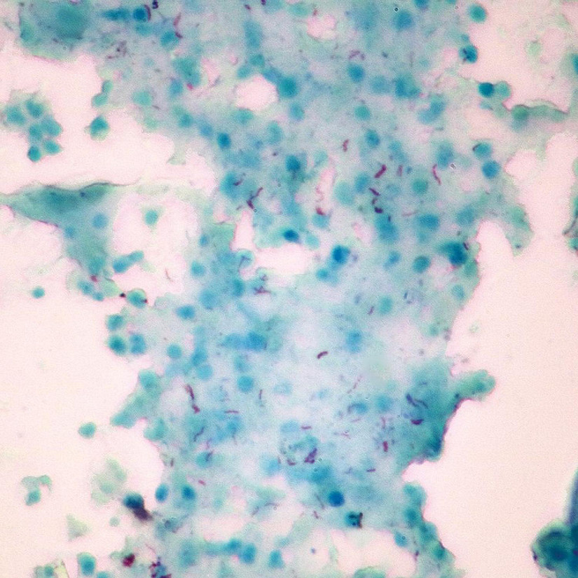 Carolina Biological Supply Company Mycobacterium tuberculosis, w.m. Microscope Slide Image