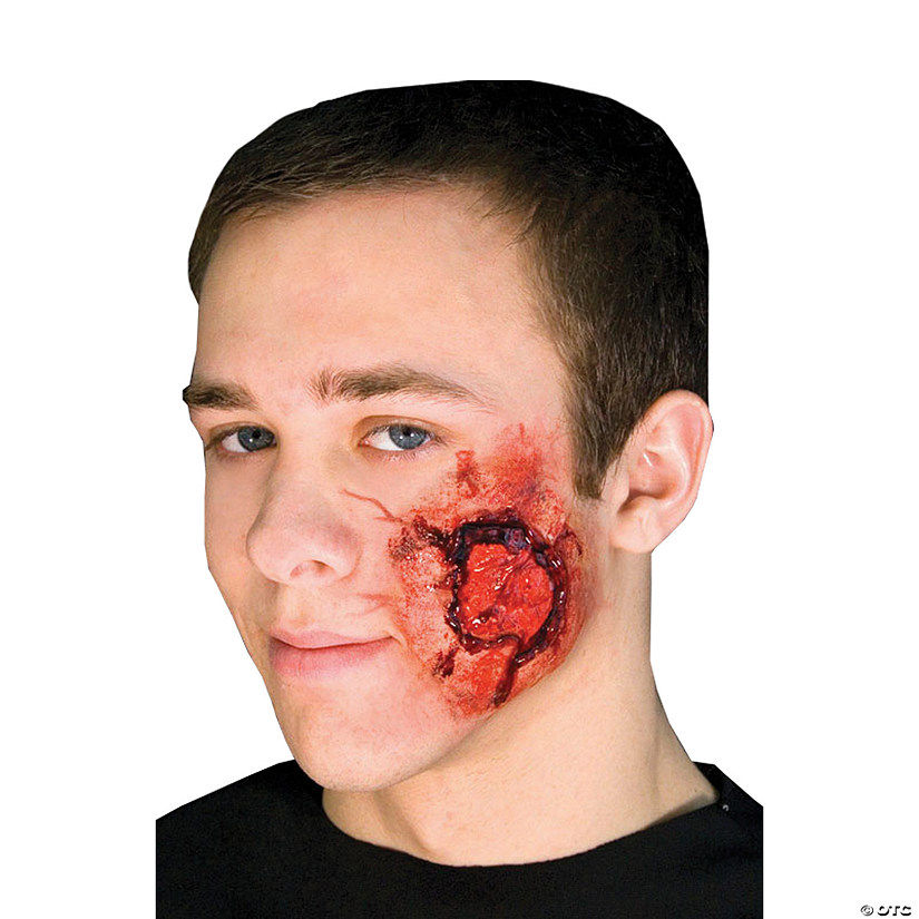 Open Wound Prosthetic Image