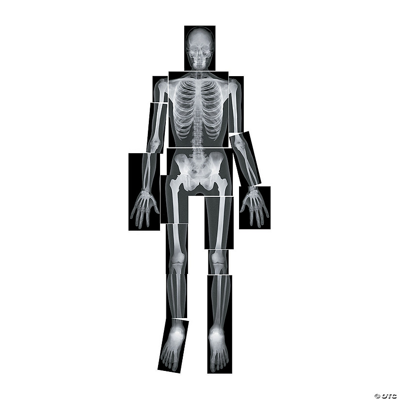 Roylco True To Life Human X-Rays Image