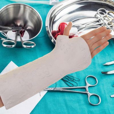 Novelty Arm Cast Dress Accessory Costume Accessory Image 2