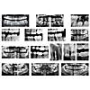 Roylco Dental Xrays Image 1
