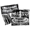 Roylco Dental Xrays Image 3