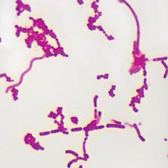 https://s7.orientaltrading.com/is/image/OrientalTrading/SEARCH_BROWSE/carolina-biological-supply-company-mixed-smear-of-bacteria-types-slide-w-m--carbol-fuchsin~14377314$NOWA$