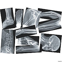 Roylco Broken Bones X-Rays